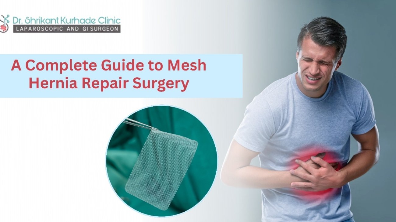 mesh hernia repair surgery guide