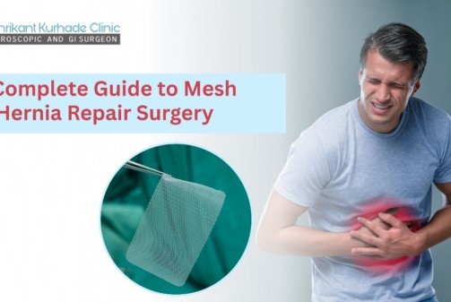 mesh hernia repair surgery guide
