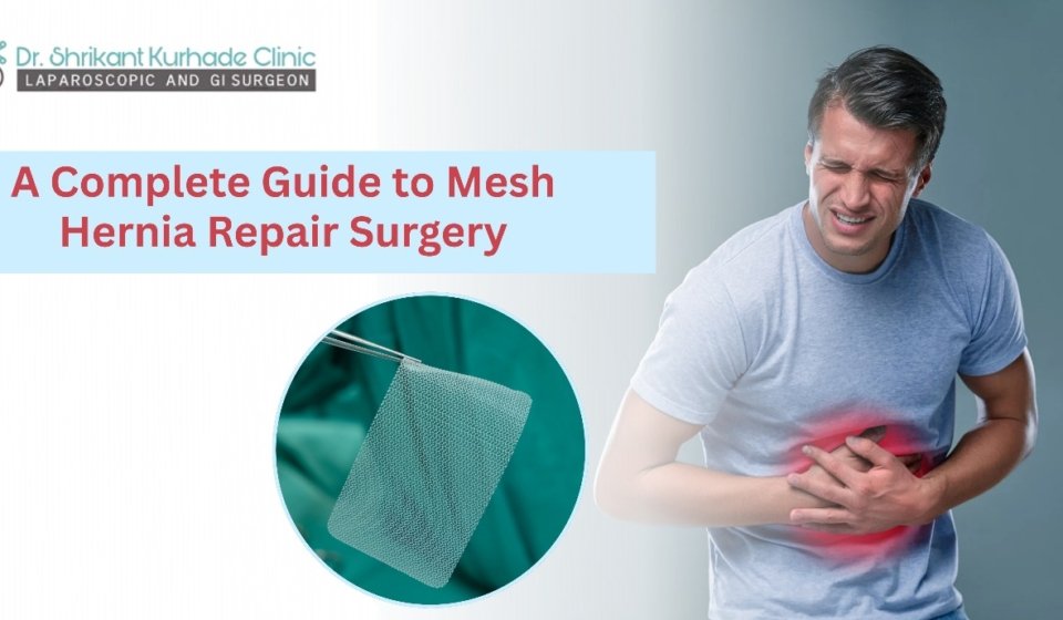mesh hernia repair surgery guide