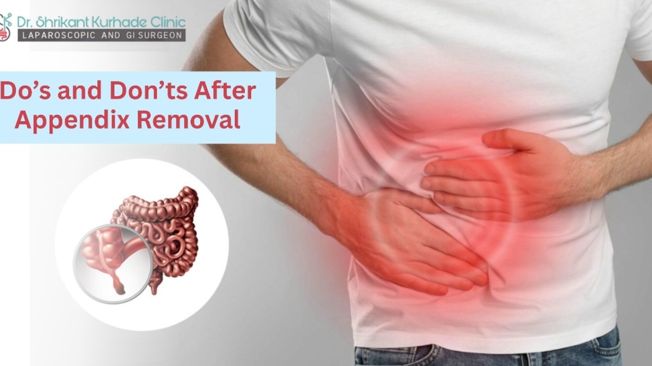 Dos and Donts After Appendix Removal