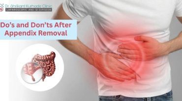 Dos and Donts After Appendix Removal