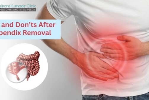 Dos and Donts After Appendix Removal
