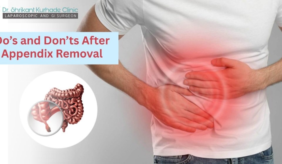 Dos and Donts After Appendix Removal