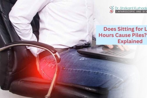 Lifestyle factors like long sitting contributing to hemorrhoids