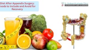 diet after appendiex surgery