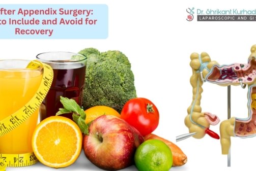 diet after appendiex surgery
