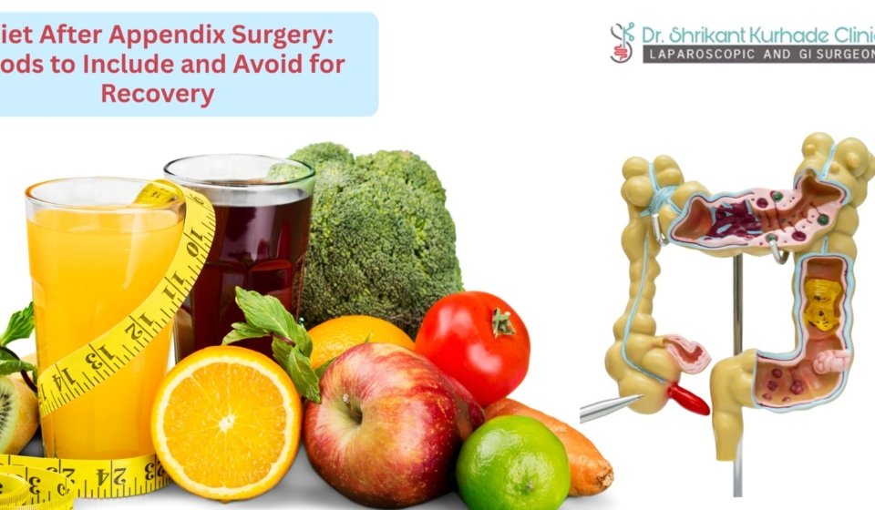 diet after appendiex surgery