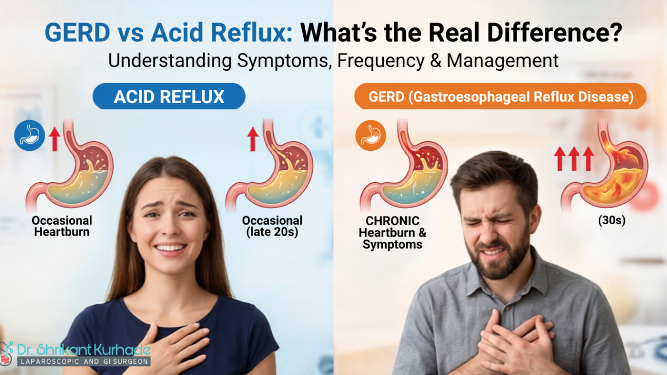 gerd vs acid reflux