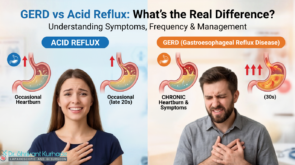 gerd vs acid reflux