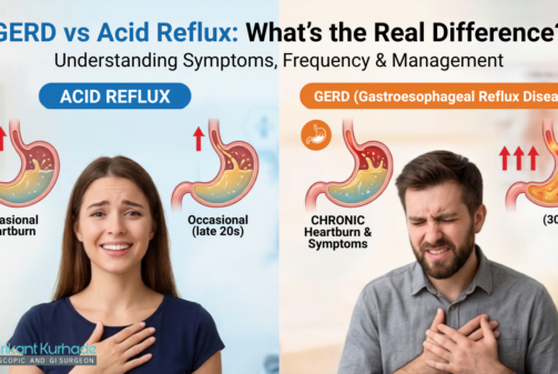 gerd vs acid reflux
