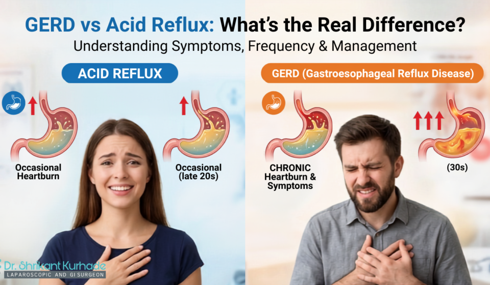 gerd vs acid reflux