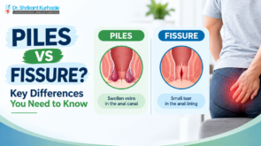 Difference between piles and fissure