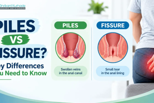 Difference between piles and fissure